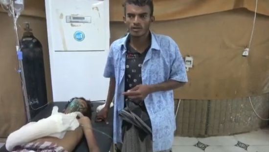 رصاصة حوثية تخترق يد طفل وتسكن بطنه