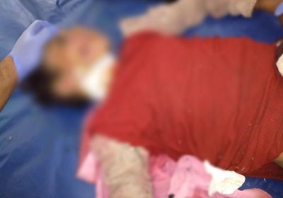 قناص حوثي يقتل طفلة شمالي الضالع