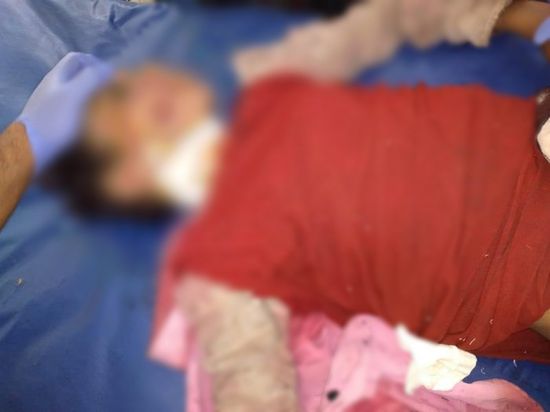 قناص حوثي يقتل طفلة شمالي الضالع