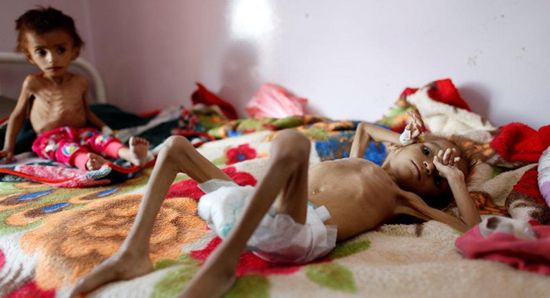أطفال اليمن.. وقود الحرب وكلفتها الباهظة