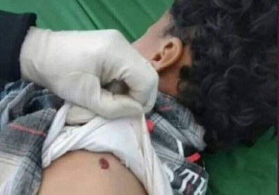 مقتل طفل بعيار ناري راجع في إب