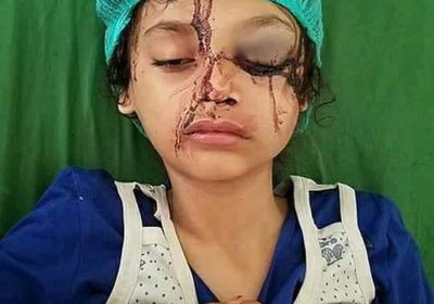 "عليا" تنضم إلى طابور ضحايا الرصاص الراجع بإب