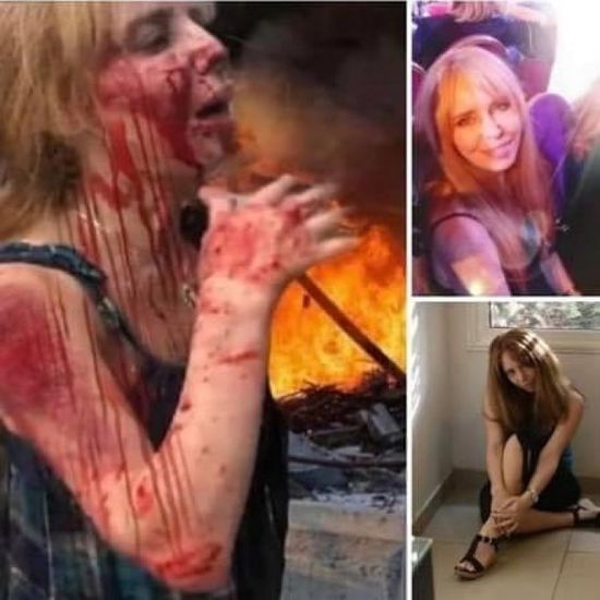 إصابة الإعلامية اللبنانية إبتسام غنيم في انفجار بيروت