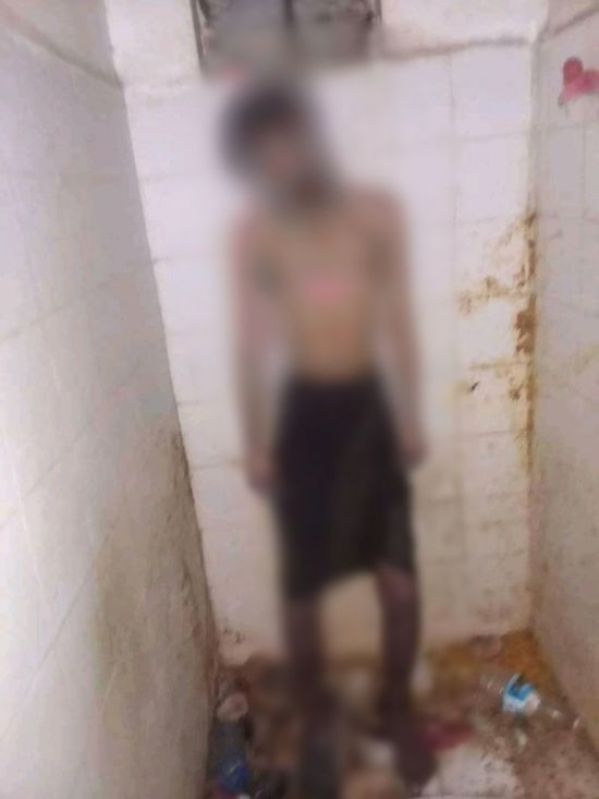في حبسه الانفرادي.. العثور على نزيل سجن إب مشنوقًا