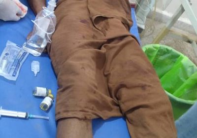 شاهد.. إصابة مزارع بقذيفة حوثية في التحيتا