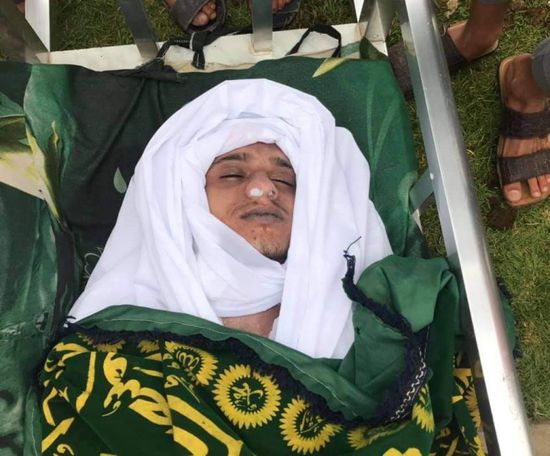 الواقعة الثالثة بأسبوع.. العثور على شاب مشنوقًا في إب