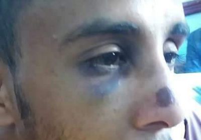 التحصيل بالبلطجة.. محصلو "الواجبات الزكوية" في إب يهاجمون عاملًا