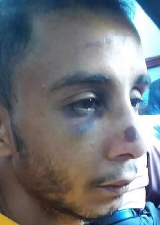 التحصيل بالبلطجة.. محصلو "الواجبات الزكوية" في إب يهاجمون عاملًا