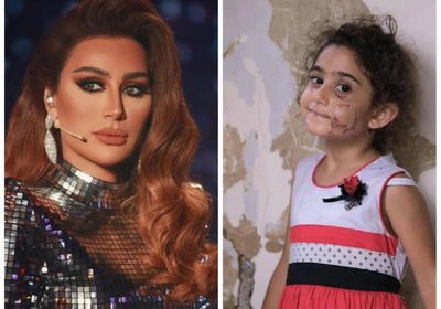 مايا دياب تتكفل بعلاج وجه طفلة تشوه جراء انفجار بيروت