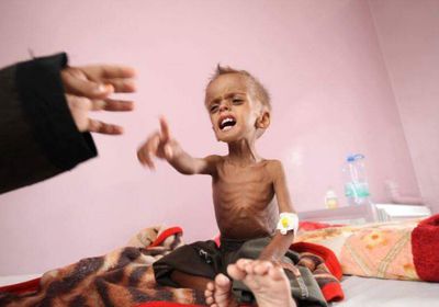  أطفال اليمن.. بين الحرب الغاشمة والكلفة الباهظة