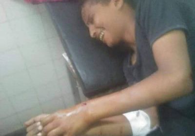 برصاص قناص حوثي.. استهداف طفل أمام منزله بتعز