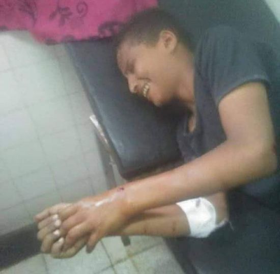 برصاص قناص حوثي.. استهداف طفل أمام منزله بتعز