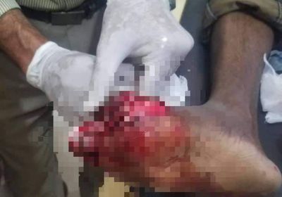 ضحية ثانية لبراميل القمامة "المتفجرة" في تعز