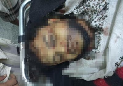 العثور على جثتين لشخصين مقتولين بالرصاص شرقي زنجبار بأبين