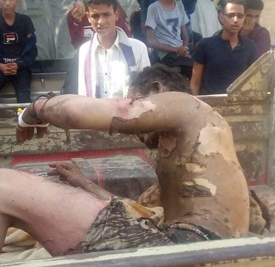 محاولة انتحار "سجين الجحف" تشغل الرأي العام في إب