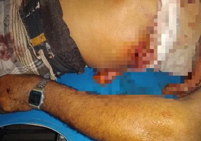 في الحديدة.. شاب يقتل والديه وجاره رميا بالرصاص (صور)