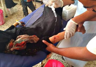قناصة الحوثي تُصيب سيدتين شمالي الضالع