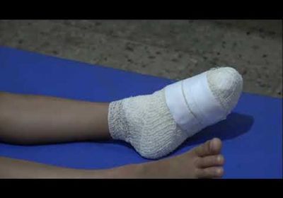 شاهد.. جرح طفلة في التحيتا برصاص الحوثيين (فيديو)