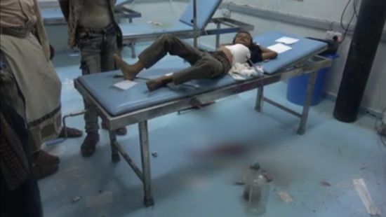 في واقعة جديدة.. رصاص الحوثيين يصيب طفلا في حيس