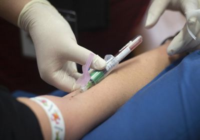 "كيورفاك‎" CureVac‎ ‎‏ تجري تجارب سريرية للقاح كورونا على أول متطوع