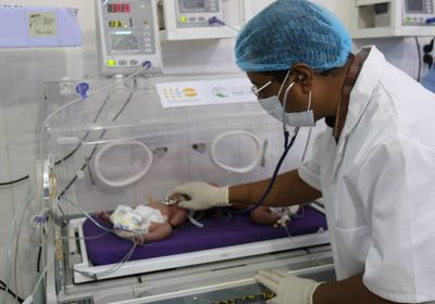 ولادة طفلين سياميين بمستشفى سيئون