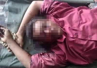 انفجار لغم حوثي يمزق شابا في حيس