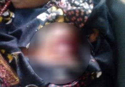 تخصصت بقتل الأطفال.. رصاص المليشيا يغتال "غزلان" في حيس