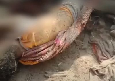 استشهاد وإصابة مواطنين في قصف حوثي بالدريهمي