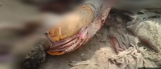استشهاد وإصابة مواطنين في قصف حوثي بالدريهمي