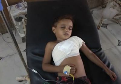 شاهد.. قذيفة هاون حوثية تصيب طفلة في الدريهمي