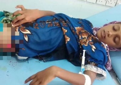 إصابة طفلة برصاص مليشيا الحوثي في الجبلية