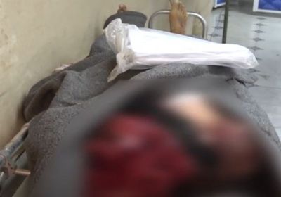 فصلت رأسه عن جسده.. مليشيا الحوثي تقتل عاملًا بالحديدة