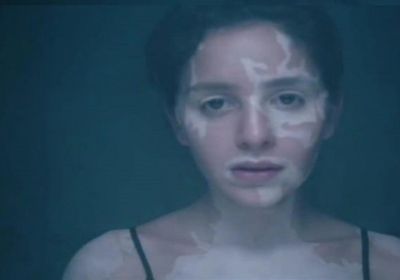 "مأساة الفتيات مع البهاق".. جميلة عوض تتحدث عن دورها في "إلا انا"