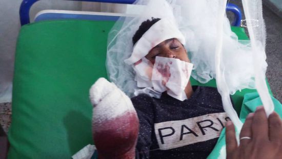 قذيفة حوثية تصيب طفلا بجروح خطيرة في الفاخر