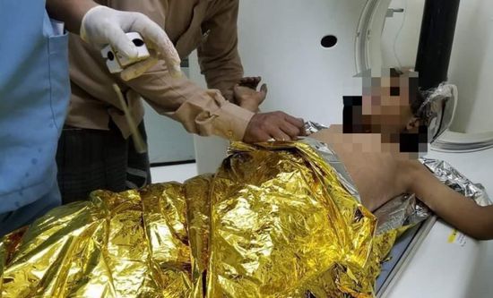 استشهاد طفل بعد إصابته في القصف الحوثي على تعز