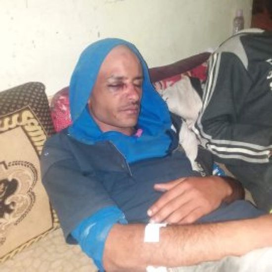عصابة حوثية تعتدي على 3 مواطنين بالخناجر بإب