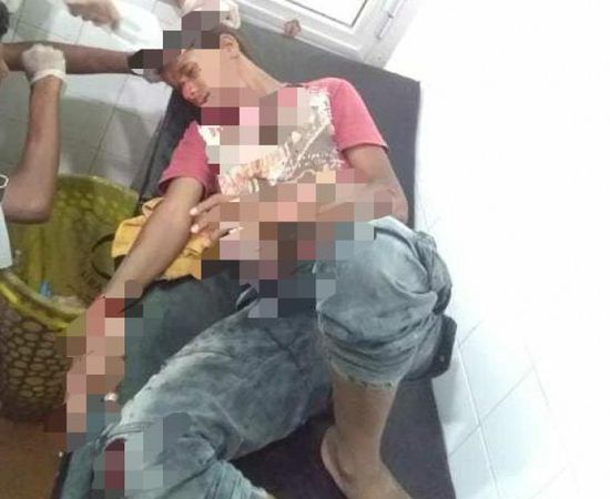 مصابان بحادثين مروريين في تبن
