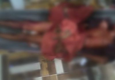 قصف حوثي يقتل ويُصيب 3 مواطنين بحيس