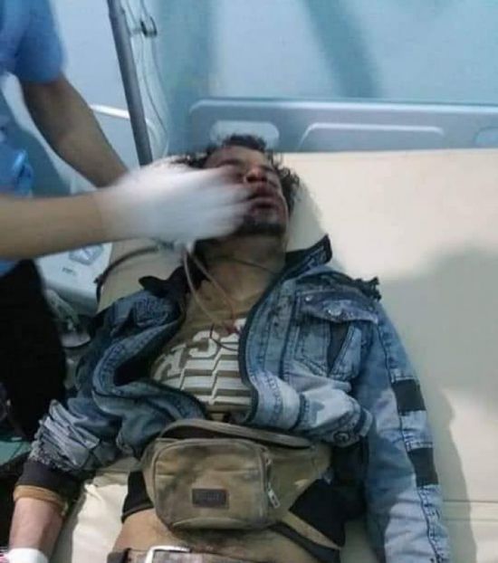 مصاب في حادث سير بمدينة إب