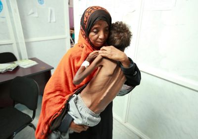  أزمة اليمن المرعبة.. كيف أشعل الحوثيون "لهيب المجاعة"؟