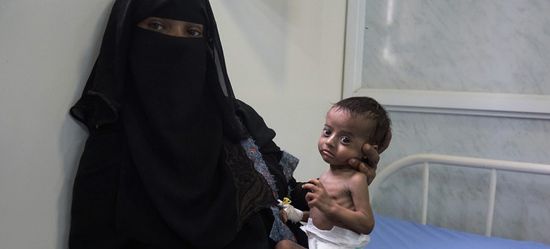 جهود مواجهة المجاعة في اليمن.. ما الذي ينقصها؟