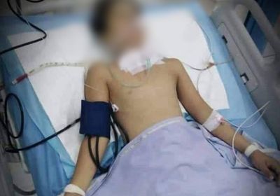 كابد الألم لأسبوعين.. جراح القصف الحوثي تغلب "الطفل غالب"