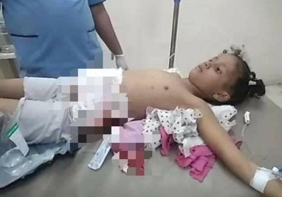 قناص حوثي يُصيب طفلة شمال تعز