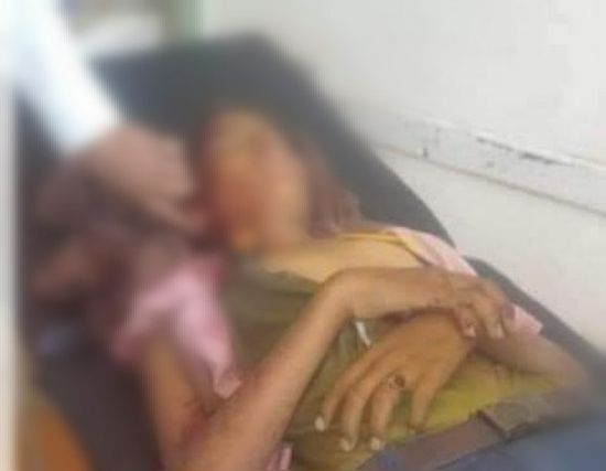 مصرع وإصابة 3 أطفال وامرأة في قصف حوثي على تعز