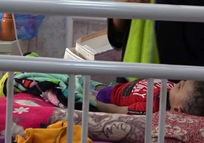 150 حالة سوء تغذية بين أطفال المكلا في شهرين