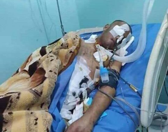 بعد 6 جراحات.. ضحية عنف الإخوان يلفظ أنفاسه بتعز