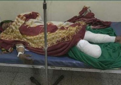 بتر ساق عشرينية صادفها لغم حوثي بتعز