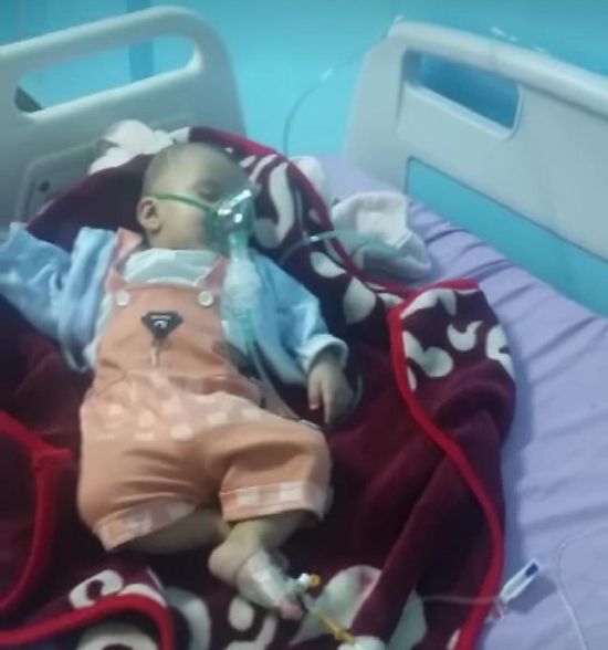 مليشيا الحوثي تترقب وفاة الطفل إدريس في صمت