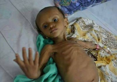  "دفعة نحو الموت".. لماذا يعمل الحوثيون على غلق قضية الطفل إدريس؟