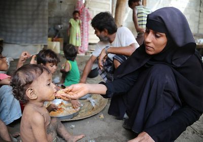 سوء التغذية في اليمن.. غول متوحش صنعه الحوثي والشرعية
